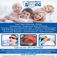 Wyndham Smile | Laser Teeth Whitening image 1